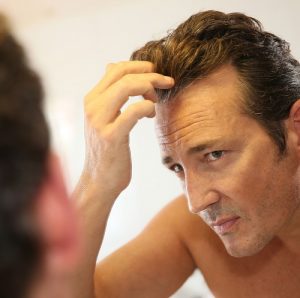 haartransplantation_geheimratsecken_kosten_bei_hoher _stirn haartransplantation_geheimratsecken_kosten_bei_hoher _stirn