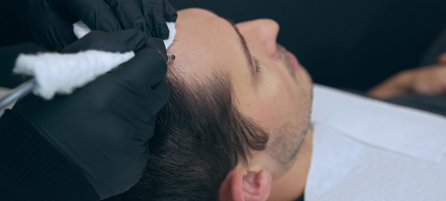 Creatin und Haarausfall Zusammenhang? » meinehaarklinik.de