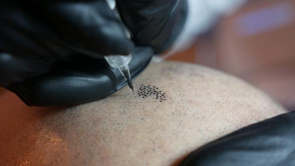 Haarpigmentierung als Lösung bei Haarausfall