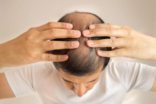 Haartransplantation-mit-der-FUT-Technik-gegen-Haarausfall-1
