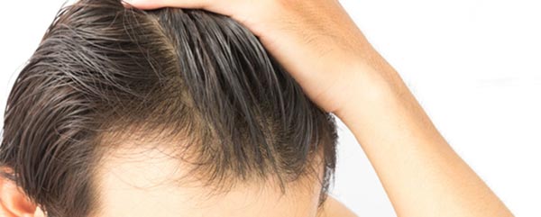 Haartransplantation-mit-der-FUT-Technik-gegen-Haarausfall-2