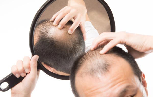 Welche-Vorteile-und-Nachteile-hat-die-DHI-Technik-bei-Haarausfall